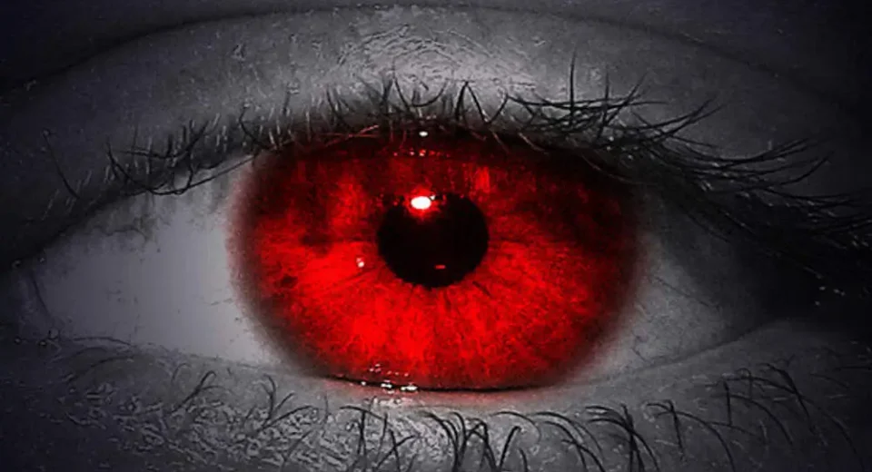 its eyes are bloodshot pagalworld